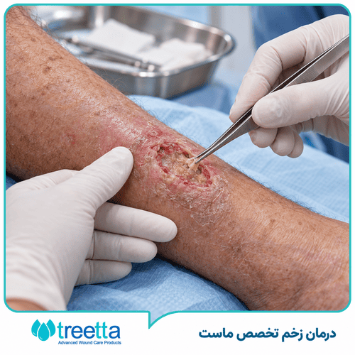 دبریدمان زخم چیست؟ چه زمانی ضرورت دارد؟