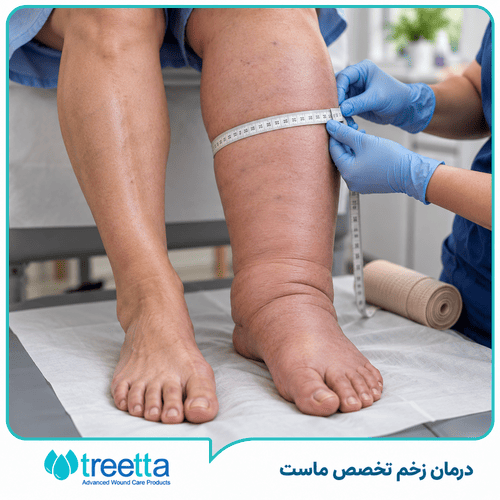 لنف ادم چیست؟