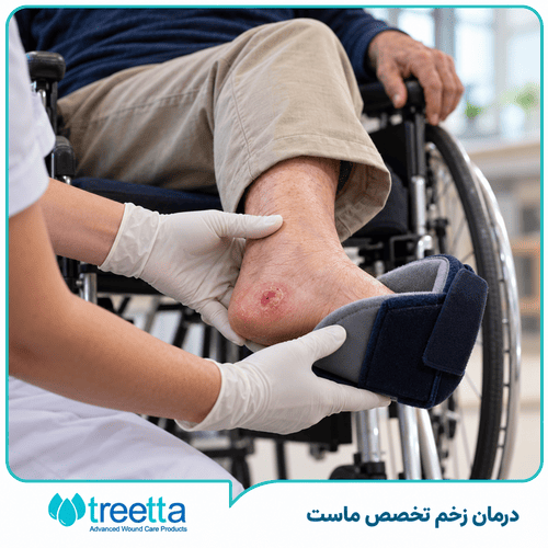 درمان زخم بستر در بیماران ضایعه نخاعی