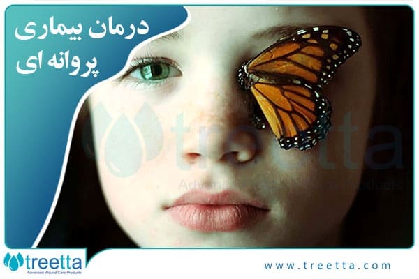 انواع بیماری پروانه ای