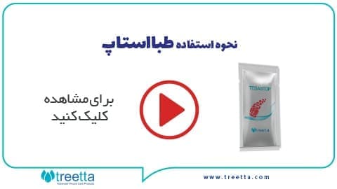 نحوه استفاده طبااستاپ