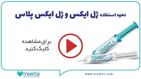 نحوه استفاده ژل ایکس