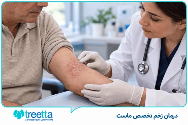 نحوه ایجاد اگزما