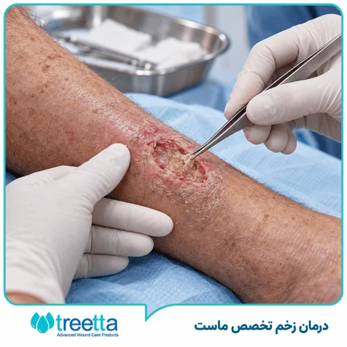 دبریدمان زخم چیست؟ چه زمانی ضرورت دارد؟
