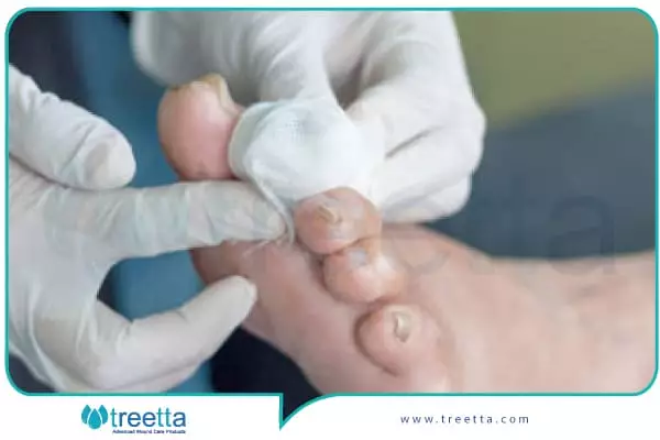 اگر میزان پتاسیم افراد مبتلا به کتواسیدوز دیابتی در طول درمان پایین باشد ، باید برای جبران آن اقدام شود.