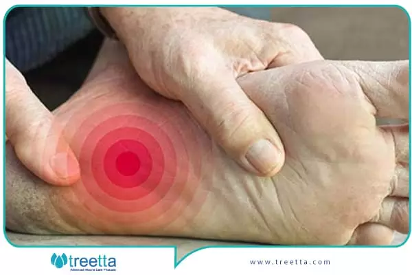 علائم نوروپاتی