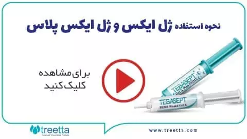 نحوه استفاده ژل ایکس